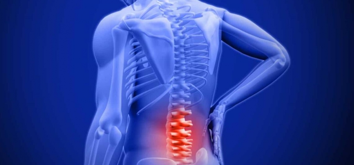 Qué es la Lumbalgia Laboral y cómo reclamar indemnización por la ART